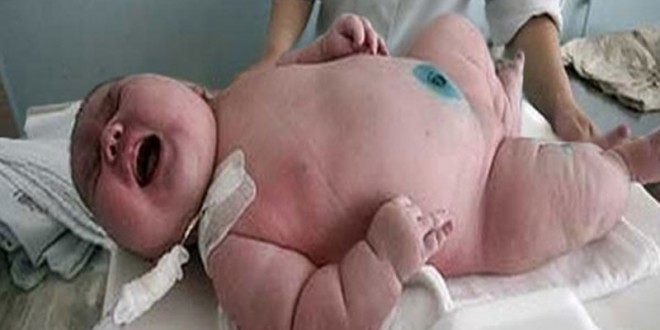 Mulher dá à Luz um Bebé com 15kg e 800 gramas!