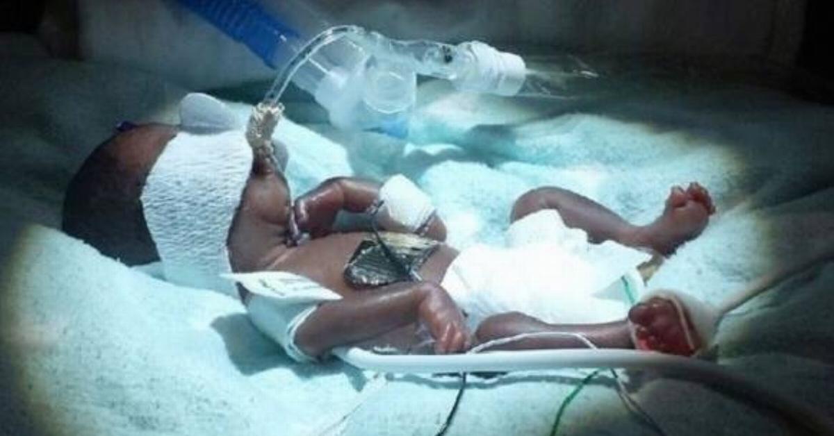 Ela pensou que o diabo queria levar seu bebé. Os médicos não podiam acreditar no que aconteceu neste parto.