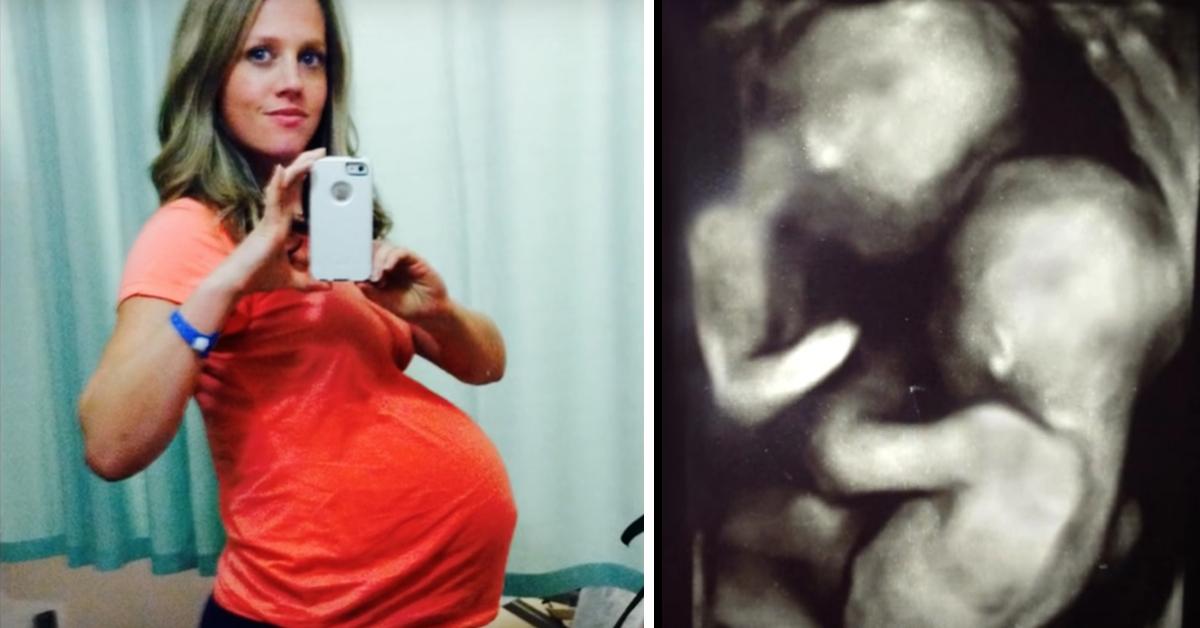 Ela está grávida de gémeos, mas então os médicos vêm algo muito estranho no ultrassom.