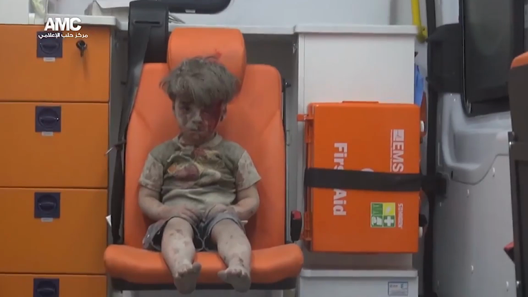 Omran Daqneesh: Esta é a face mais cruel da guerra da Síria. Mas não é a única