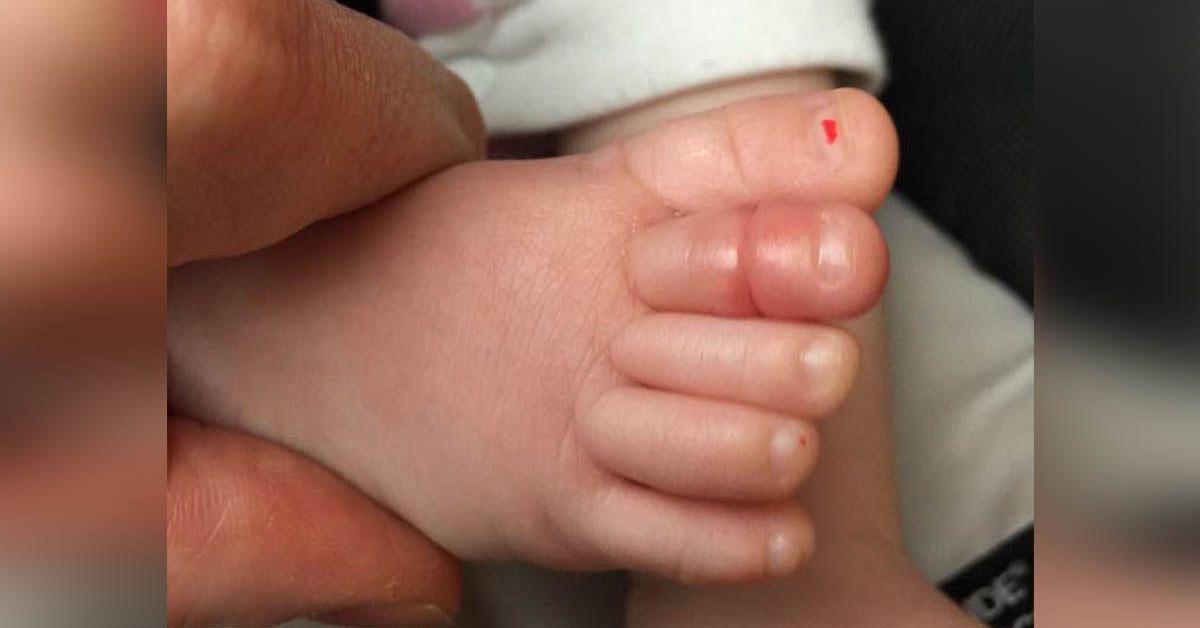 Esta bebé não parava de chorar. Foi então que seus pais viram ISTO no seu dedo do pé. Todos precisam saber sobre este perigo!