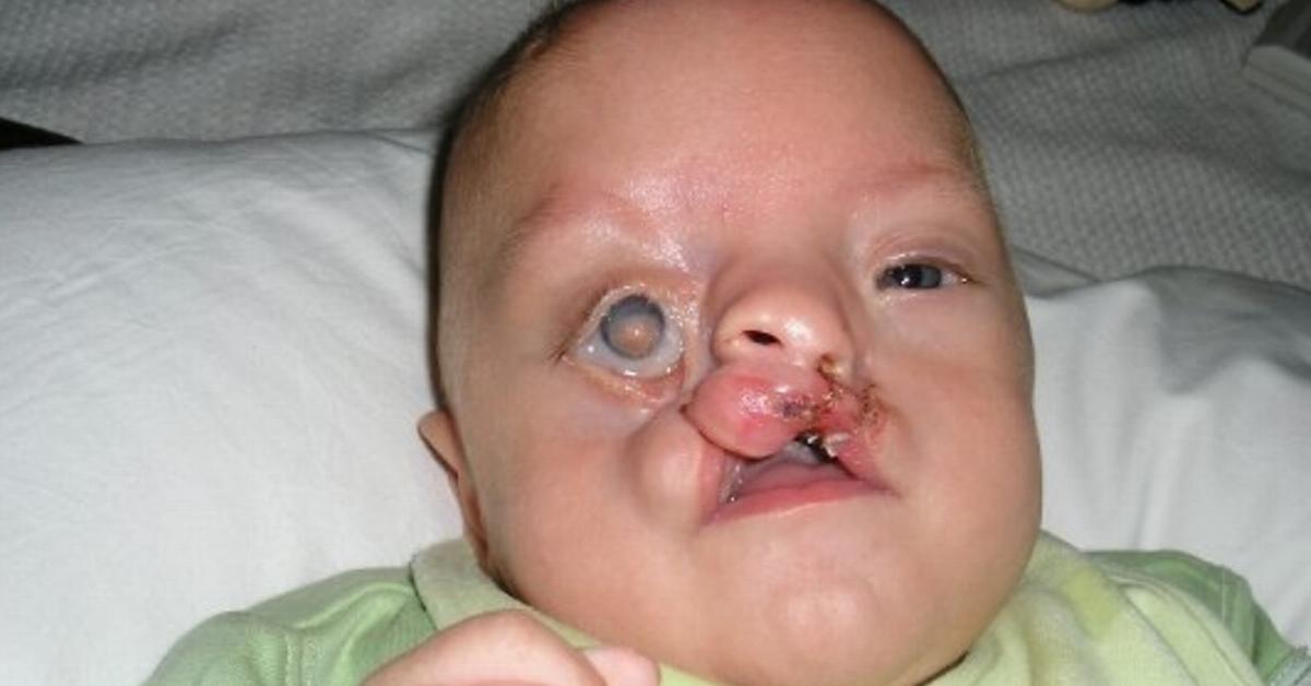 Este bebé pesa apenas 700g e tem o rosto desfigurado. 9 anos depois, a criança faz ISTO e impressiona a todos!