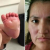 Revolta nas redes sociais com a babá que “fritou” os pés deste recém-nascido